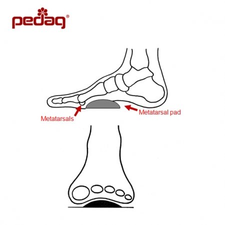 T-FORM METALARSAL PAD SUPPORT